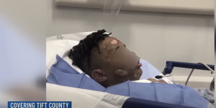 Georgia Boy Suffers Severe Burns After Friends Dump Scalding Water on Him During Sleepover 'Prank'